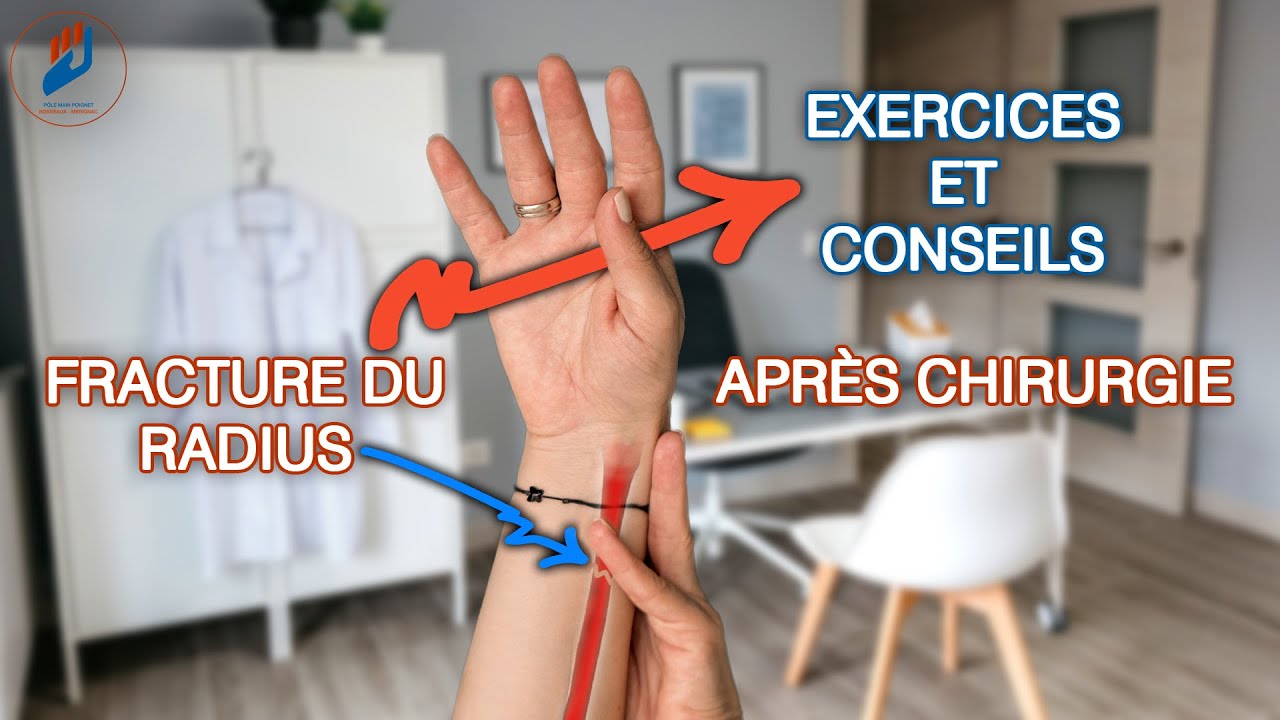 Fracture du radius : exercices et conseils d’auto-rééducation après chirurgie
