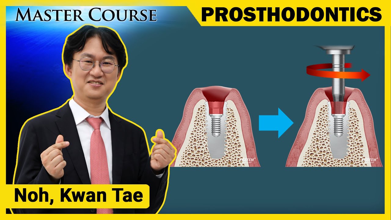 [Master Course Season2 -PROSTHODONTICS] Causes and Solutions of Abutment Fracture