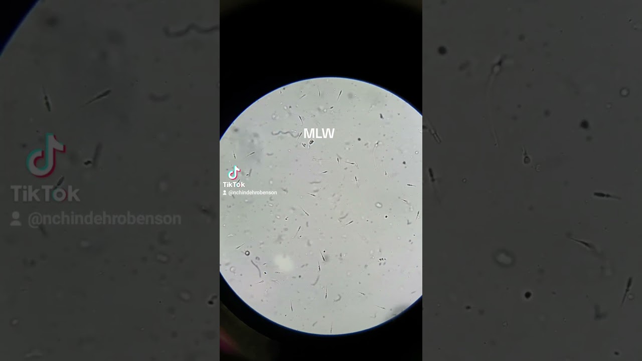 #Sperm