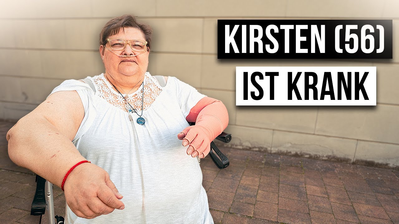 Wie ist das LYMPHÖDEM ZU HABEN?