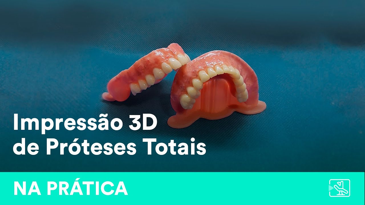 Impressão 3D de Próteses Totais | por Richard Barbosa