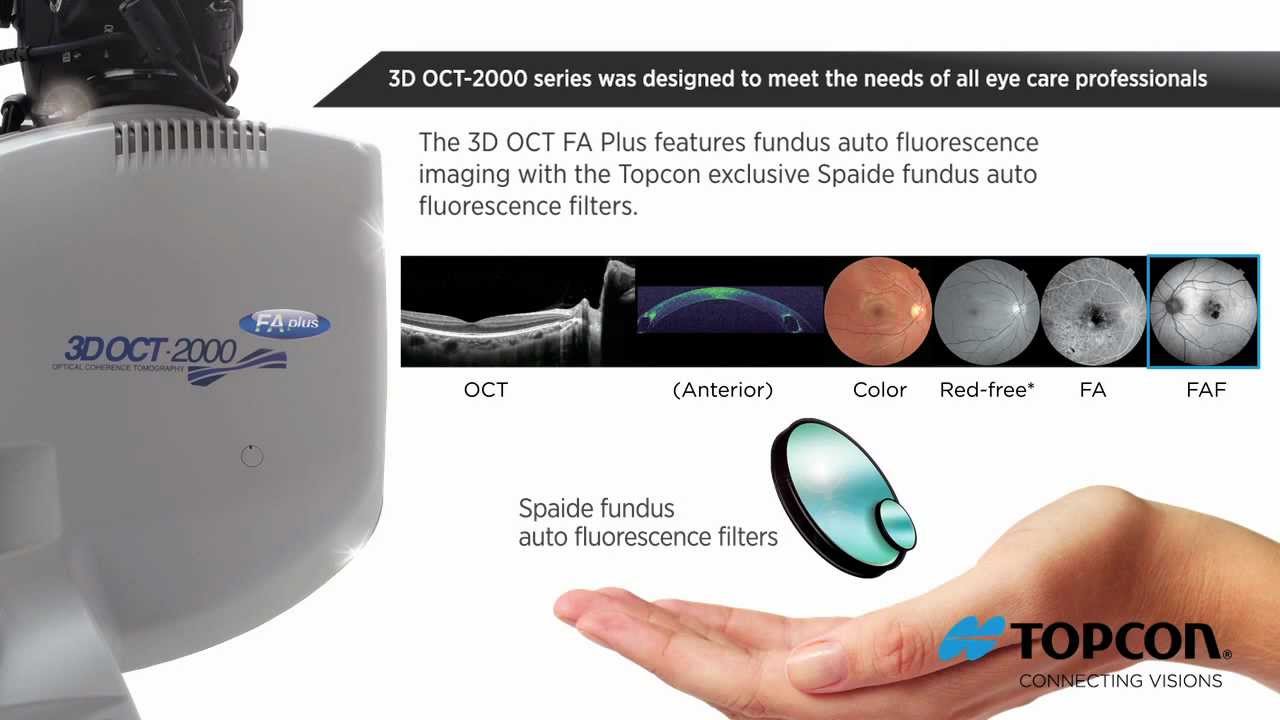 Topcon 3D OCT-2000 Demo Video