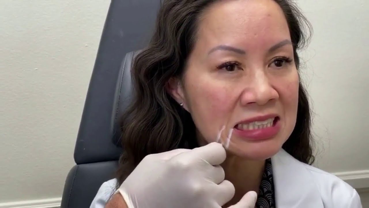 VLA: DAO Injection