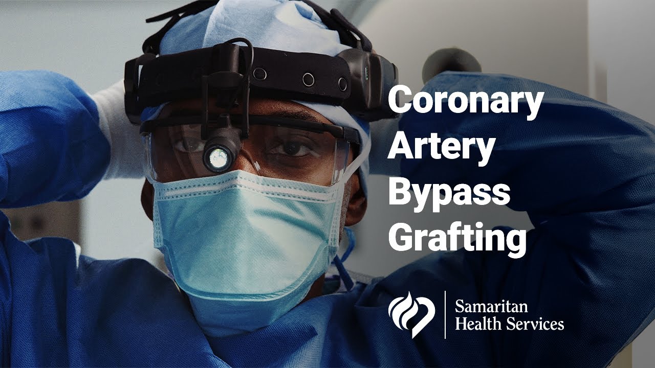Coronary Artery Bypass Grafting