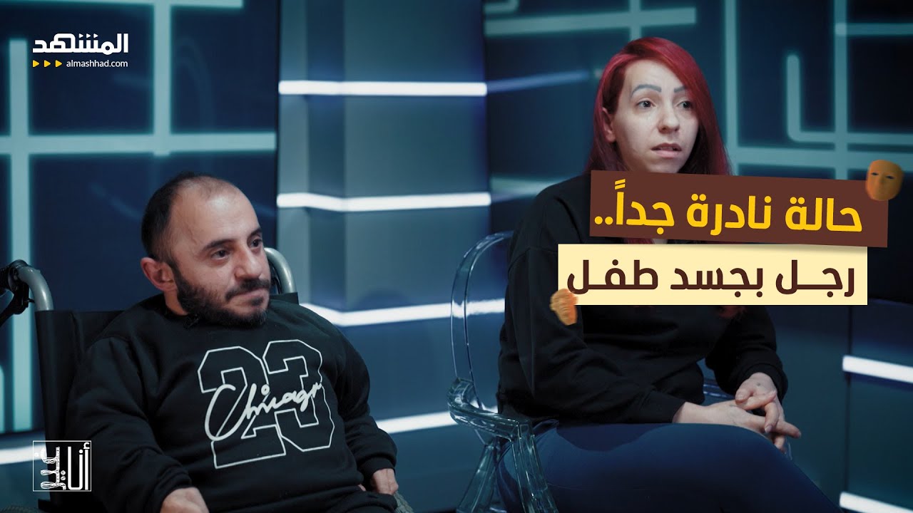 حالة نادرة جدا.. رجل بجسد طفل - أنا غير