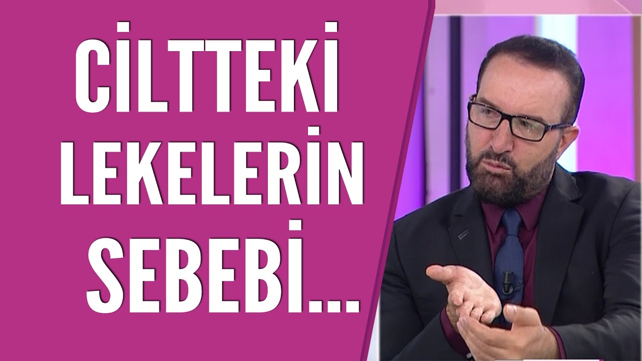 Bülent Cihantimur: Ciltteki leke tedavisi 1.5 yıl sürer