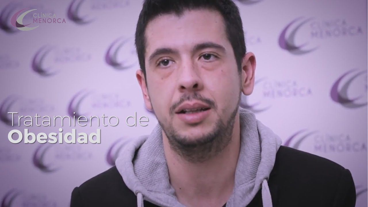 Tratamiento de obesidad : Caso Real - Cl&iacute;nica Menorca