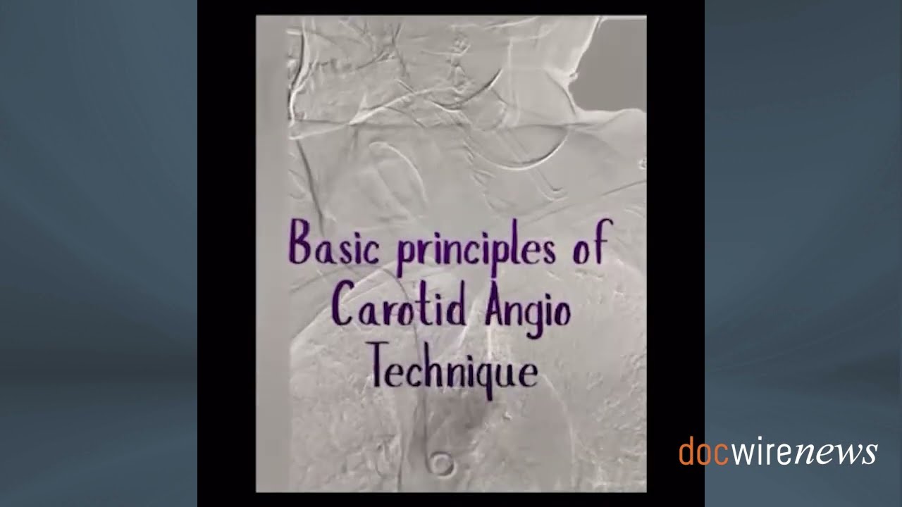 Practice Tips With Dr. Lichaa: The Basic Principles of Carotid Angiography Technique