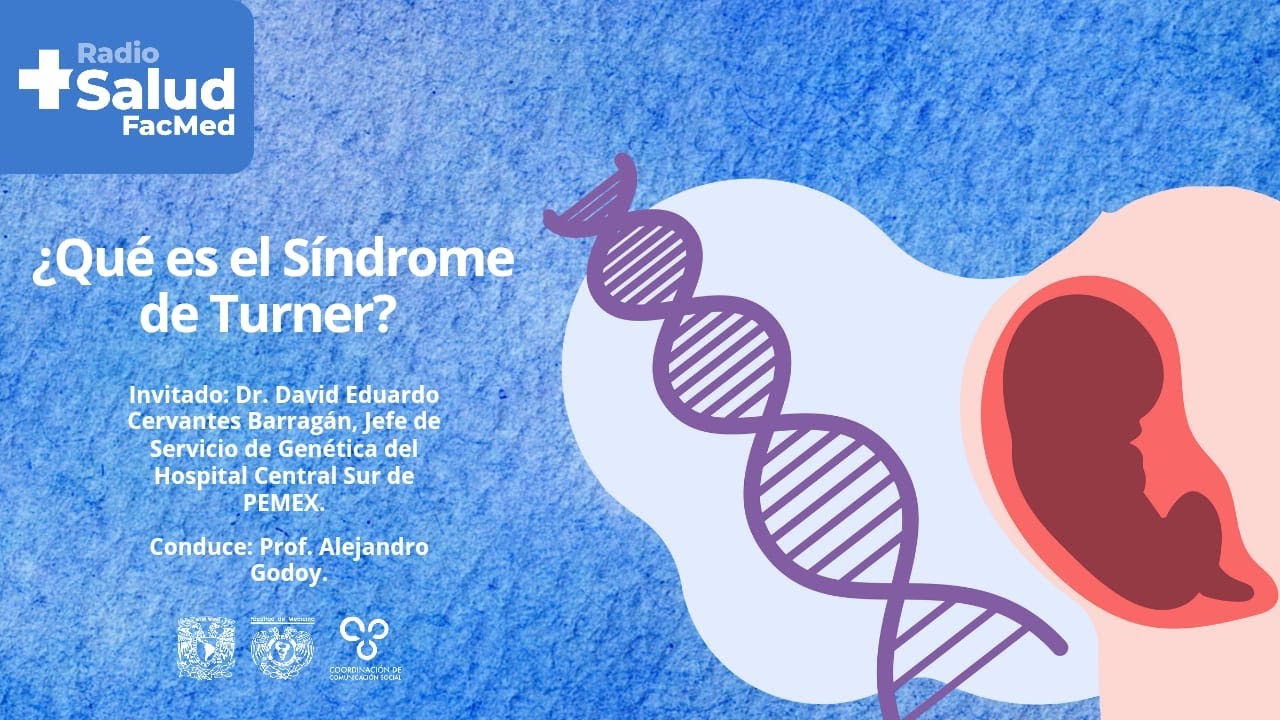 Más Salud Radio: ¿Qué es el Síndrome de Turner?