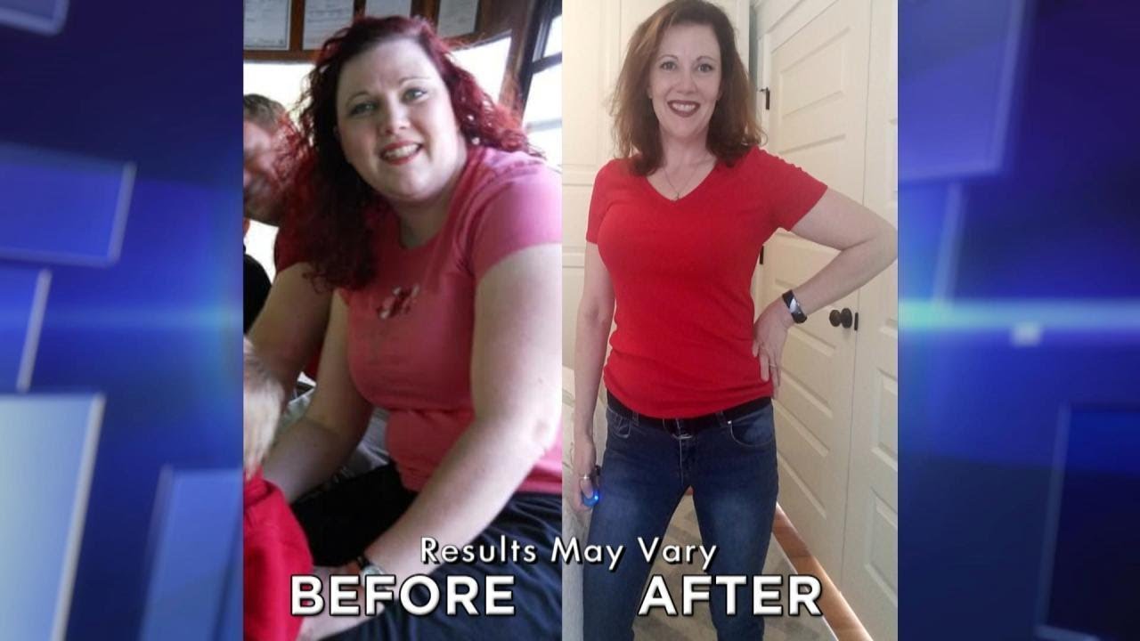 Dr. Travis Helped Me Lose My Belly!