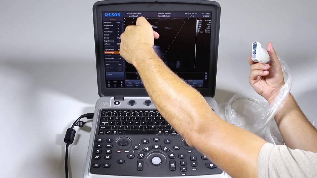 Chison SonoBook 9 Training Part 2: 2D Imaging and Optimization