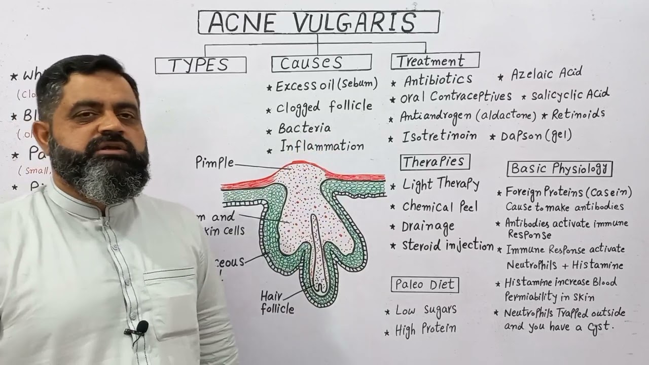 Acne Treatment Urdu/Hindi medium @Prof. Masood Fuzail| Types of Acne | Pimples Treatment Urdu