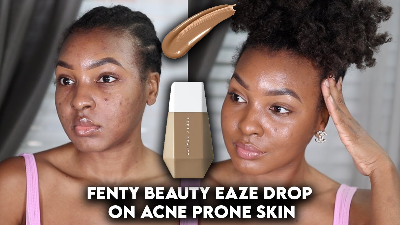 FENTY BEAUTY EAZE DROP BLURRED SKIN TINT ON ACNE PRONE & TEXTURED SKIN DEMO + REVIEW | KENSTHETIC