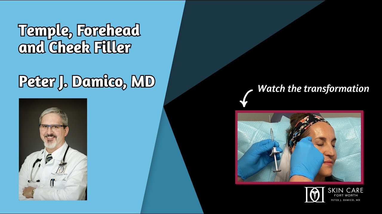 Temple Filler by Dr. Damico at Skin Care Fort Worth