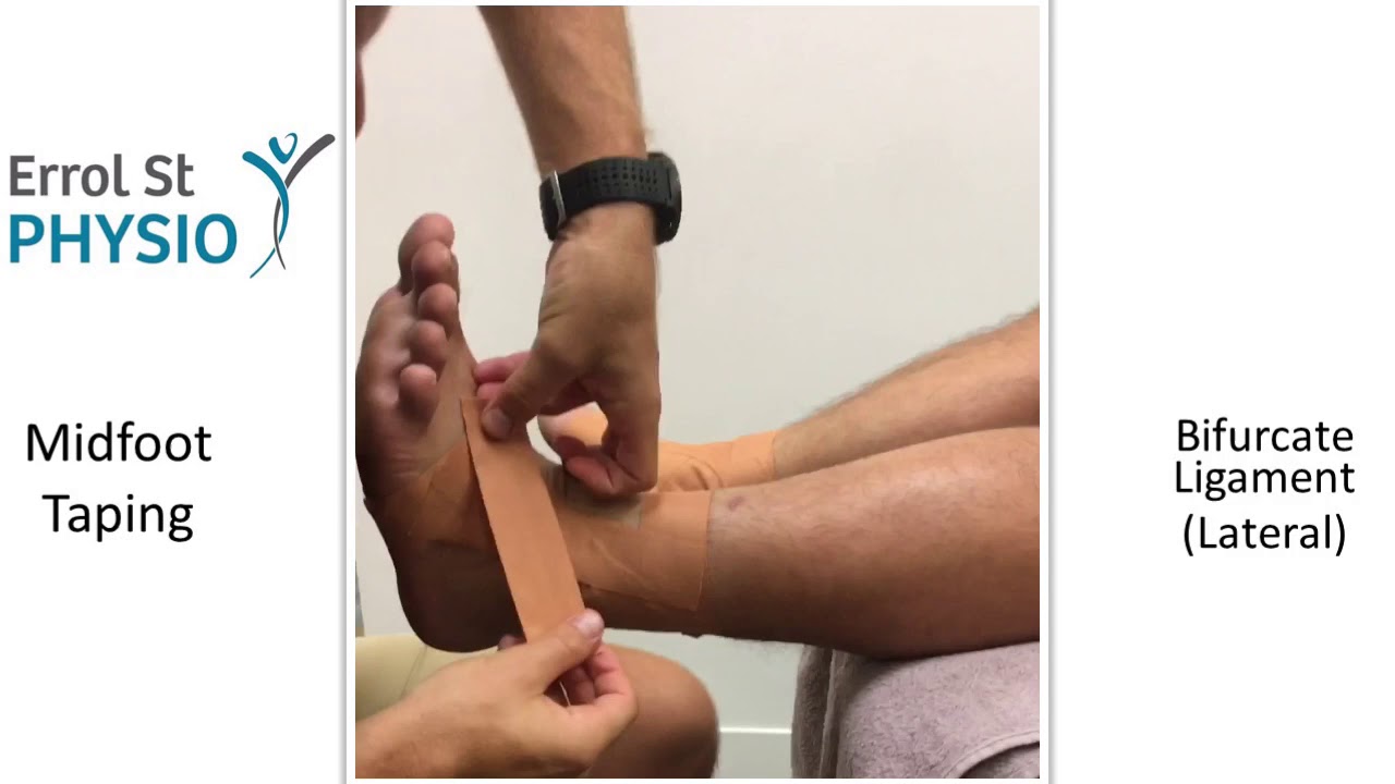 Midfoot Taping (Lateral) - Bifurcate Ligament