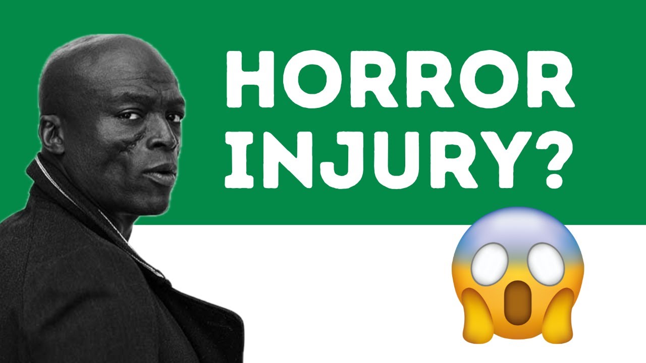 What Happened to Seal's Face?