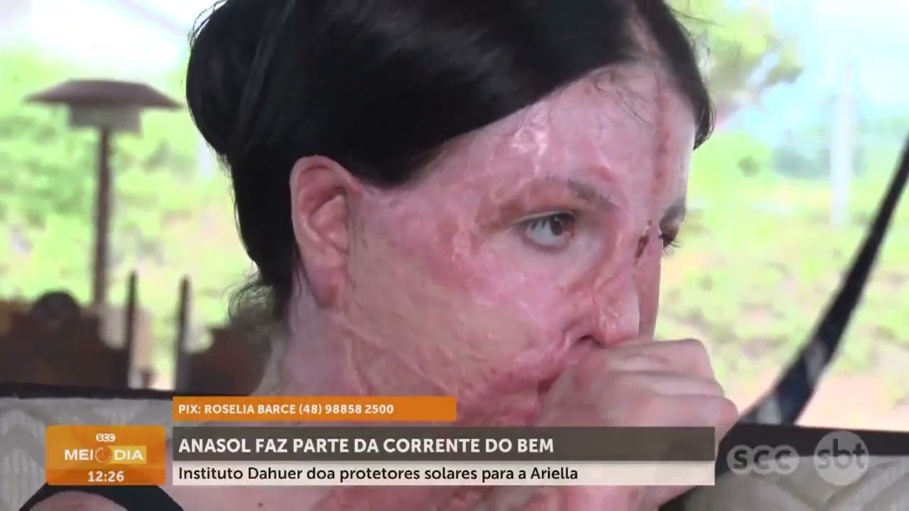 Instituto Dahuer doa protetores solares para a Ariella | Cotidiano | SCC Meio-Dia