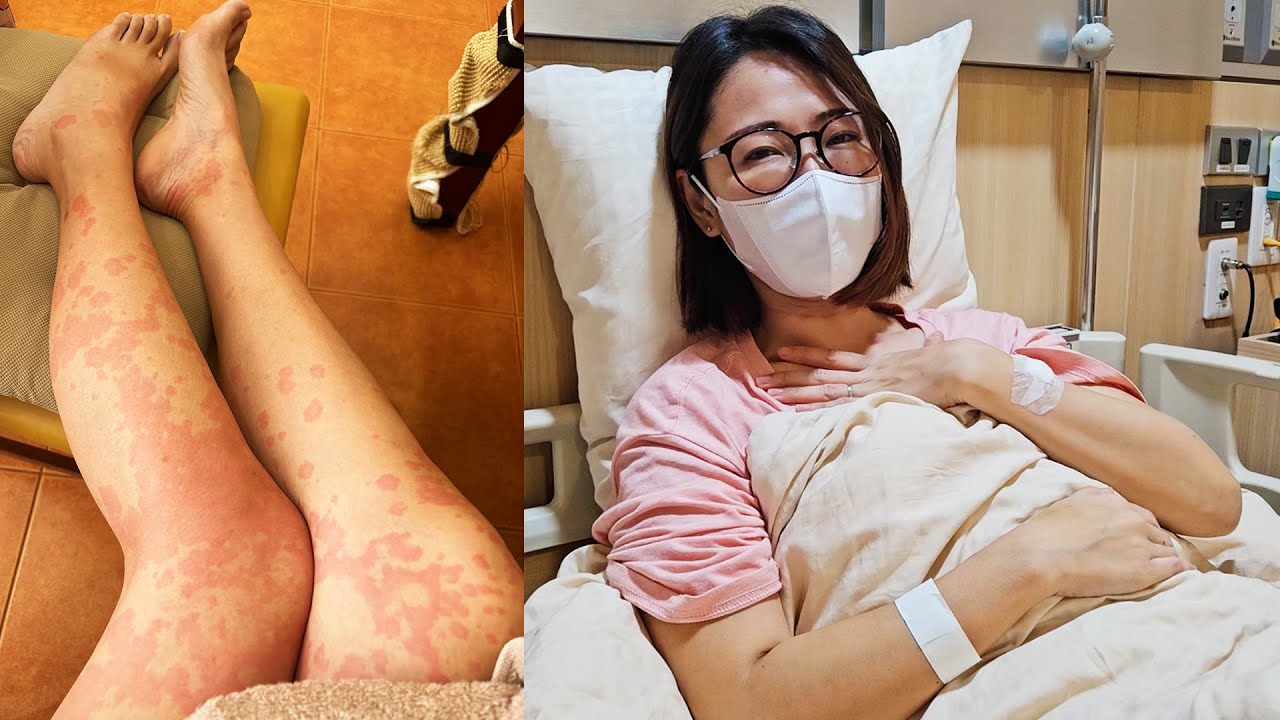 初めてバンコクで入院しました【タイ移住】
