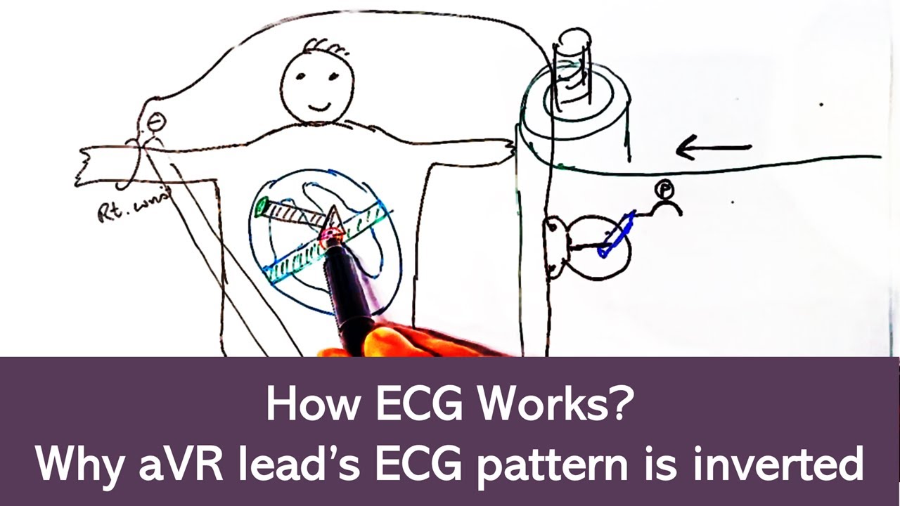 How ECG works? Why ECG pattern of aVR Lead is inverted?