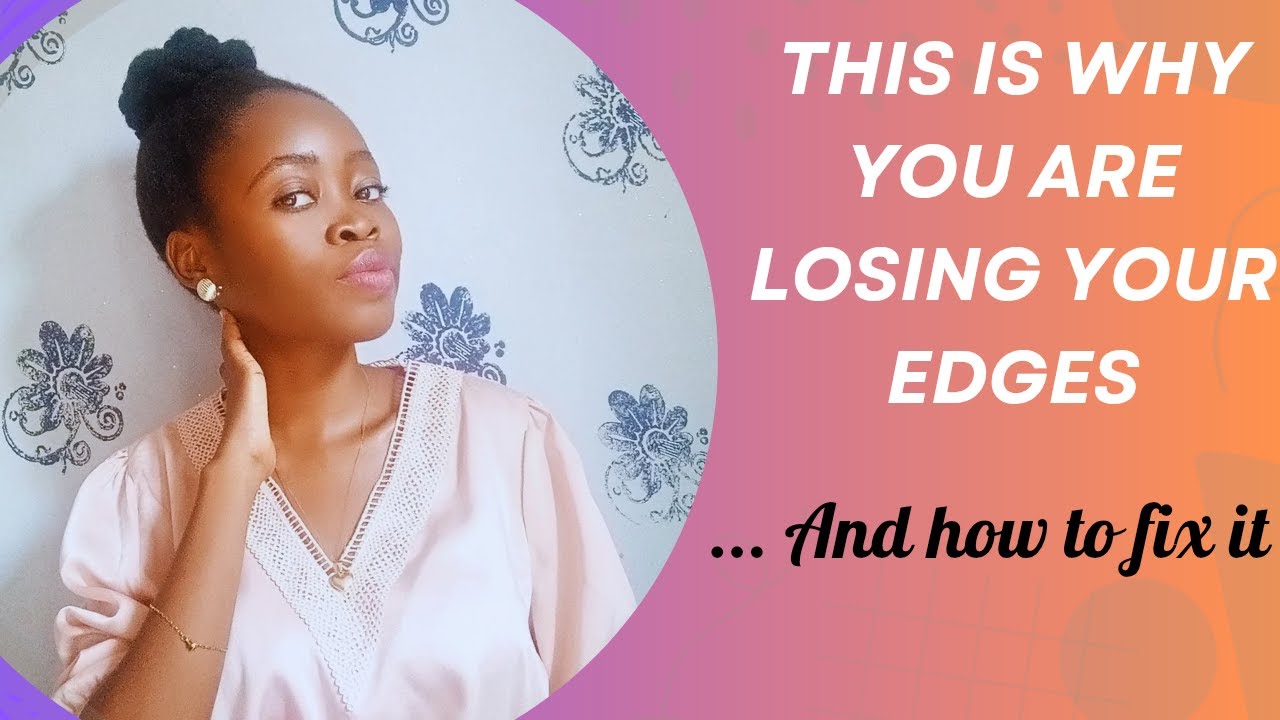 How to Grow Your Edges Back in 2025!| Say Goodbye to Thinning Hair!