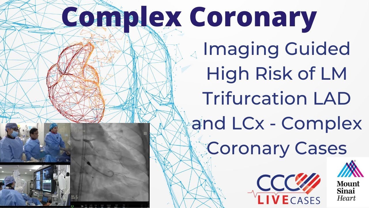 Imaging Guided High Risk of LM Trifurcation LAD and LCx - Complex Coronary Cases - February 19, 2019