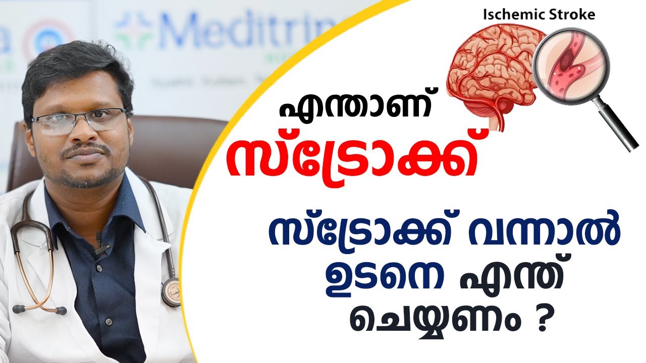 എന്താണ് സ്ട്രോക്ക് ? സ്ട്രോക്ക് വന്നാൽ ഉടനെ എന്ത് ചെയ്യണം \ stroke malayalam \ Dr. Anoop Sugunan