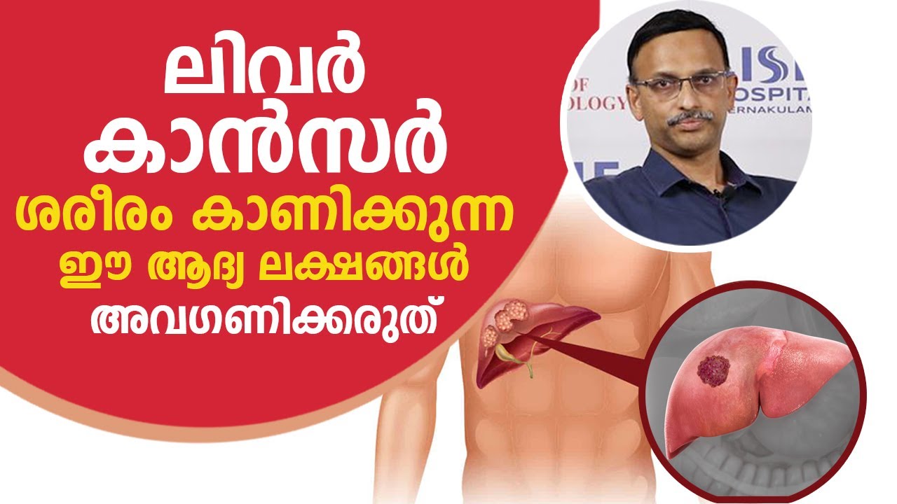 ലിവർ കാൻസർ ശരീരം കാണിക്കുന്ന ഈ ലക്ഷണങ്ങൾ അവഗണിക്കരുത് | Liver Cancer Symptoms and Treatment