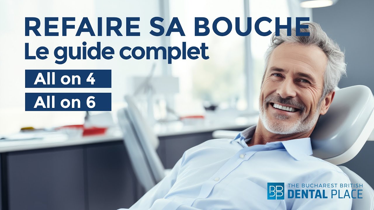 Refaire sa bouche, All on 4 et 6, Bridge Malo - Le guide complet