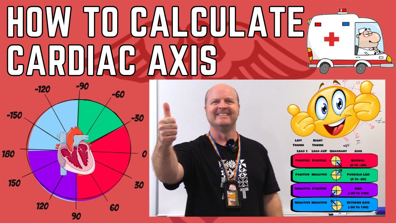 How to calculate Cardiac Axis