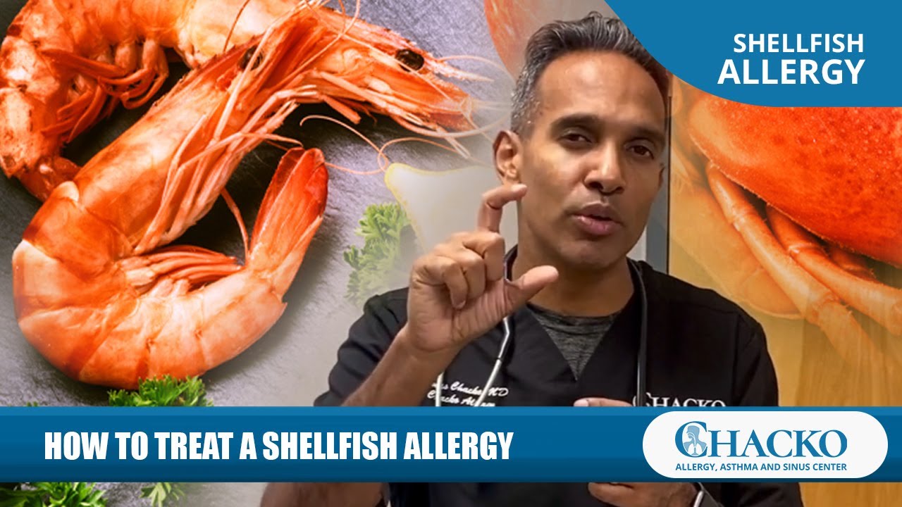 How to Treat a Shellfish Allergy [Chacko Allergy]