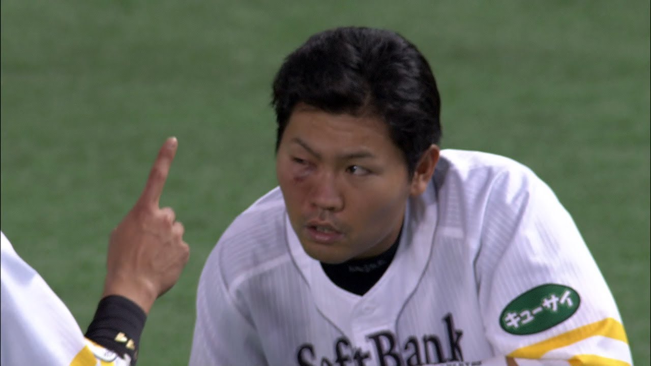中村晃に目の下が腫れるアクシデント。フェンス直撃の打球が顔面に
