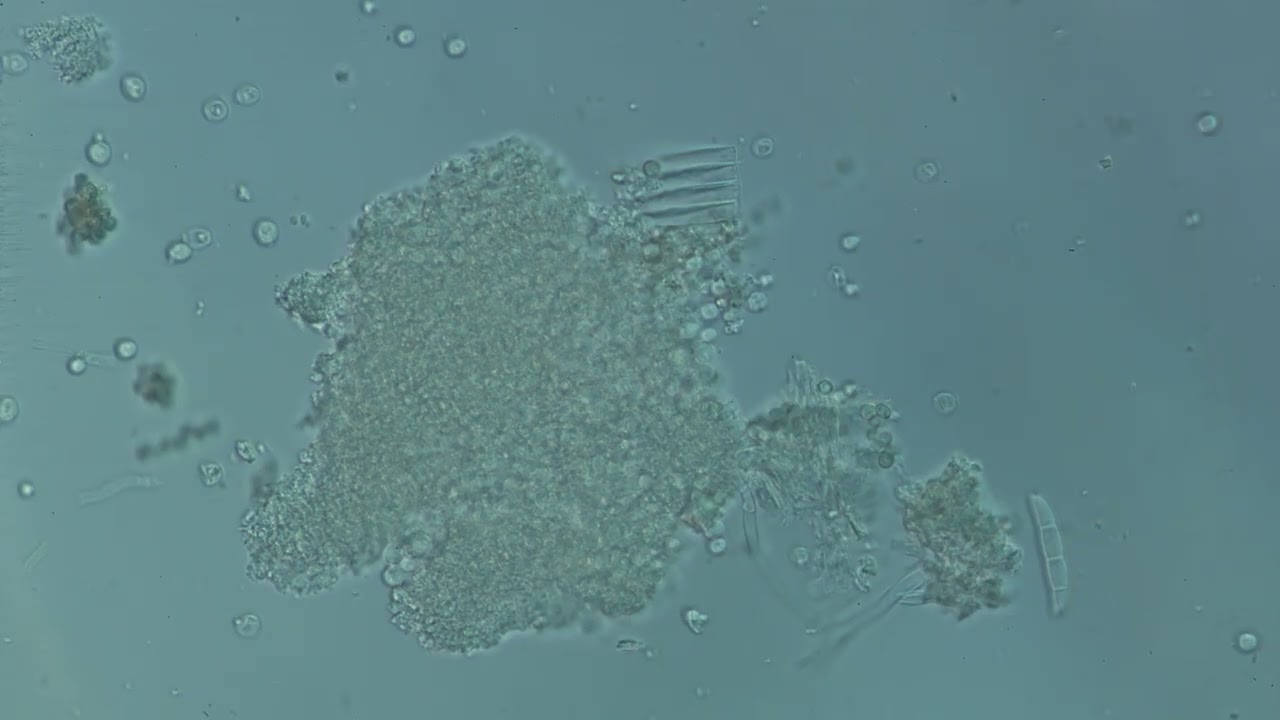 Trachelomonas (Algas)