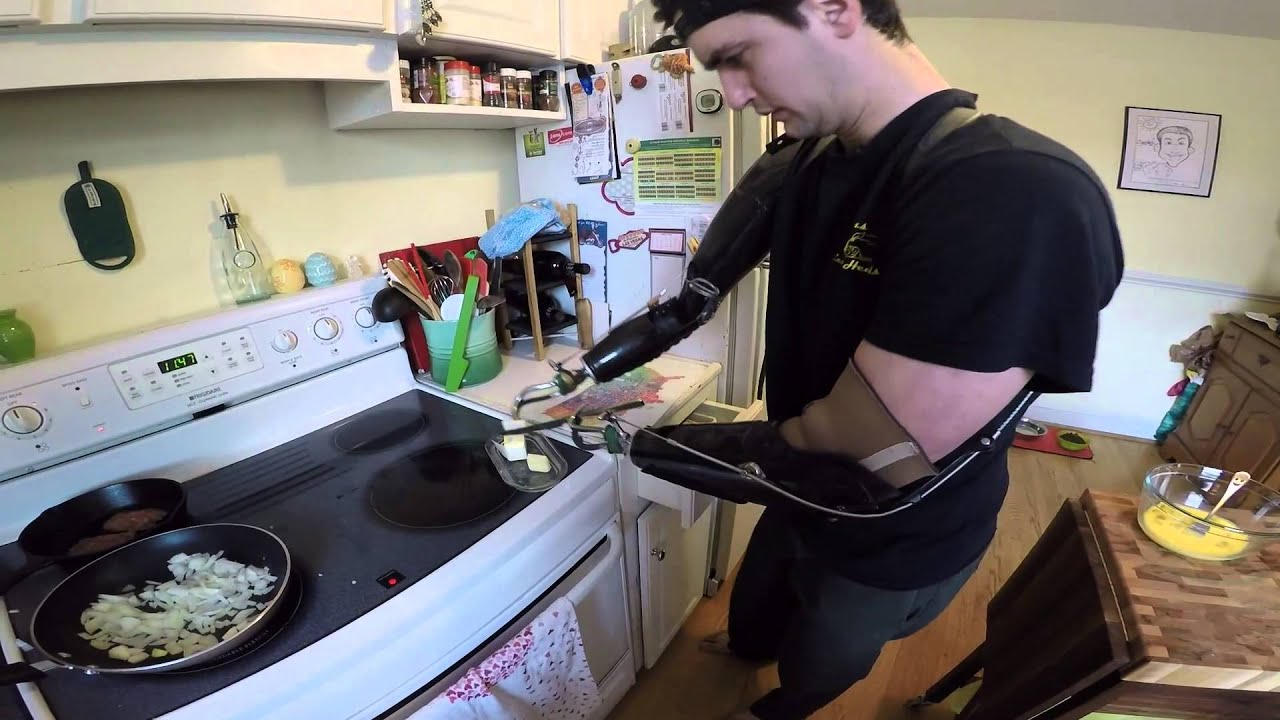 Prosthetic Arms-n-Claws...the body powered onion sizzle