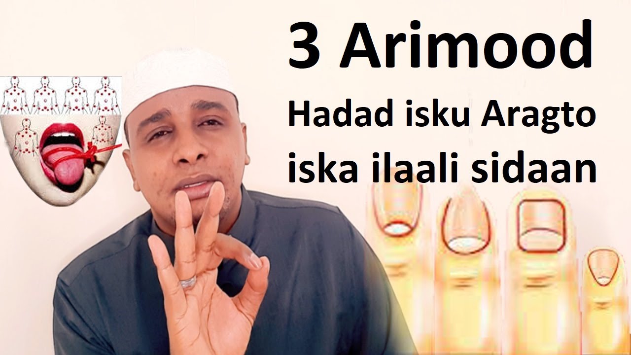 3 calaamad jirkaada ku tusayo ogow waxa ay yihiin sixir ka socda Dhinaca Dumarka iska Gaar arintan