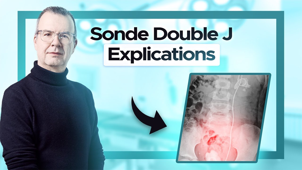 La sonde double J c'est quoi ?