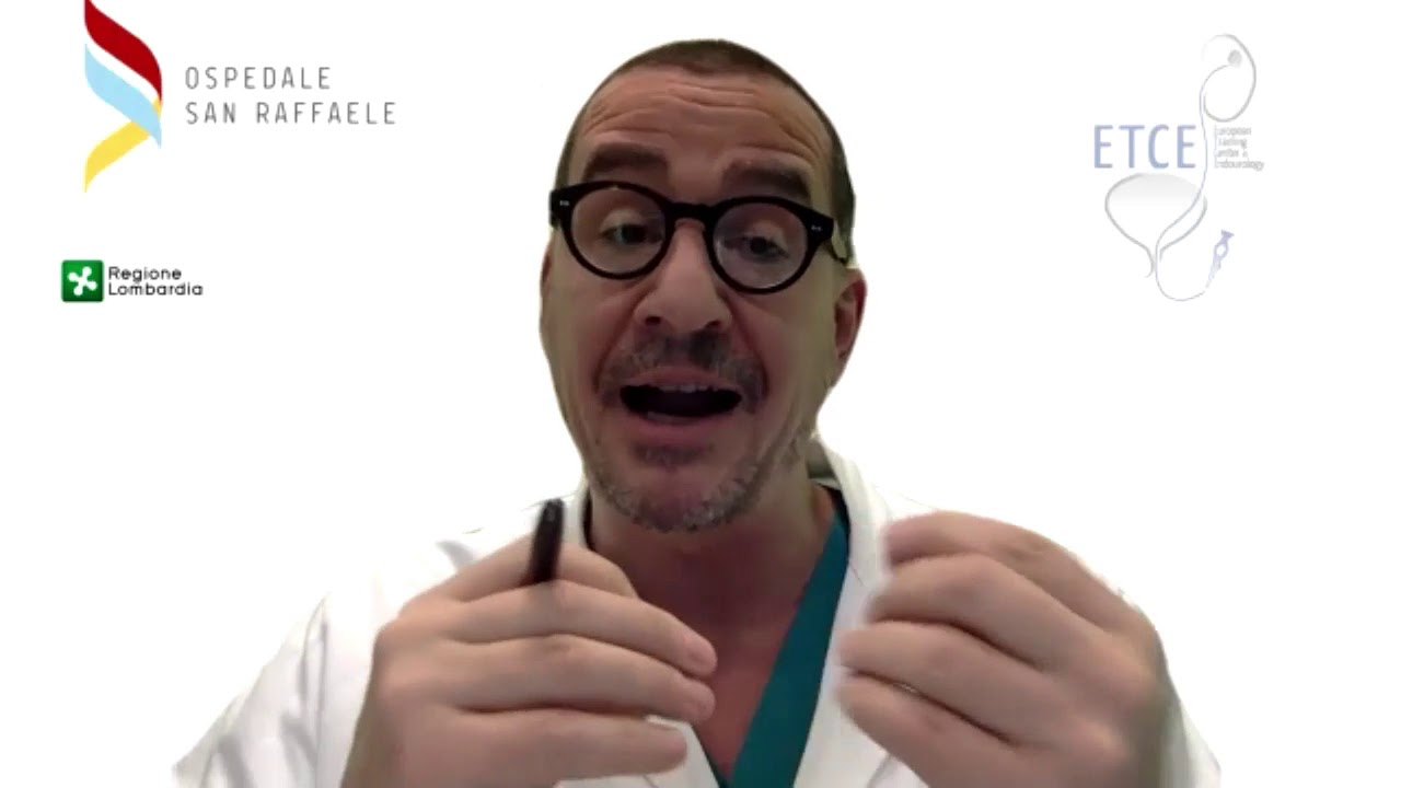 Calcoli renali: chi colpiscono, diagnosi e i nuovi interventi chirurgici per l'asportazione
