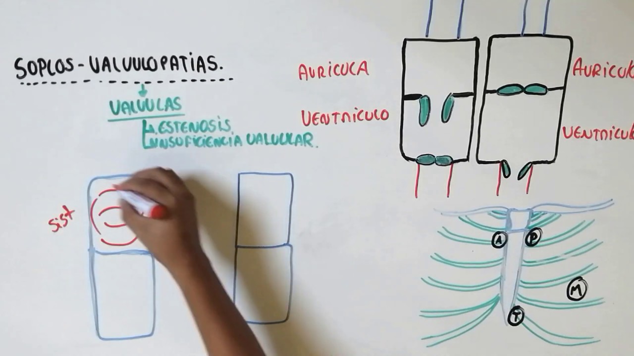 valvulopatias