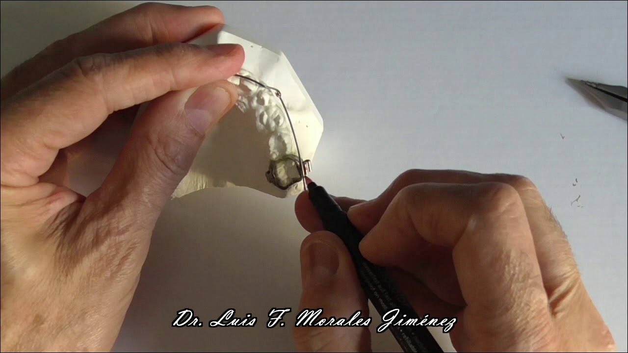 ARCO UTILITARIO DE PROTRUSION DE RICKETTS