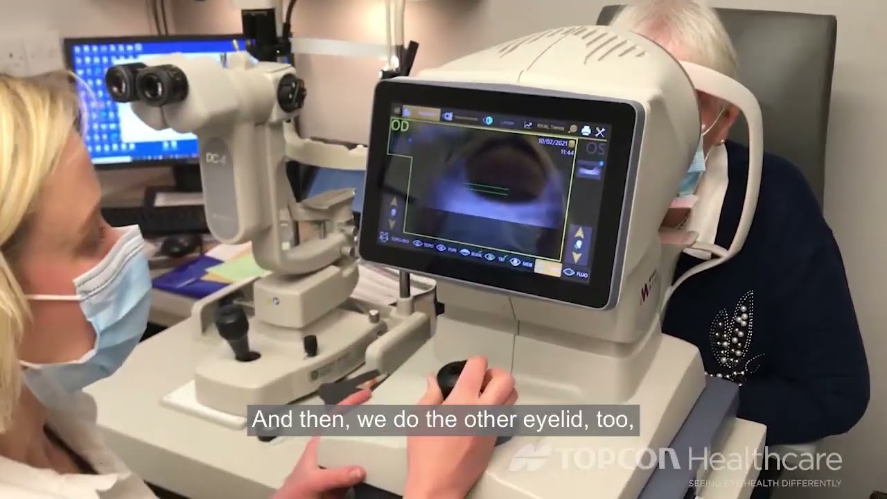 Using MYAH to Analyze Dry Eye Disease
