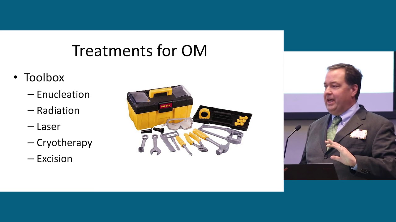 Ocular Melanoma Treatment