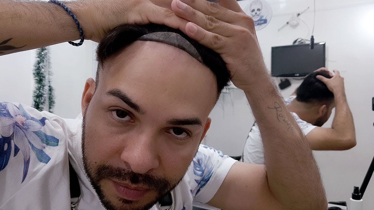Frontal da Prótese Capilar Descolou? Descubra a Solução Rápida no RJ!