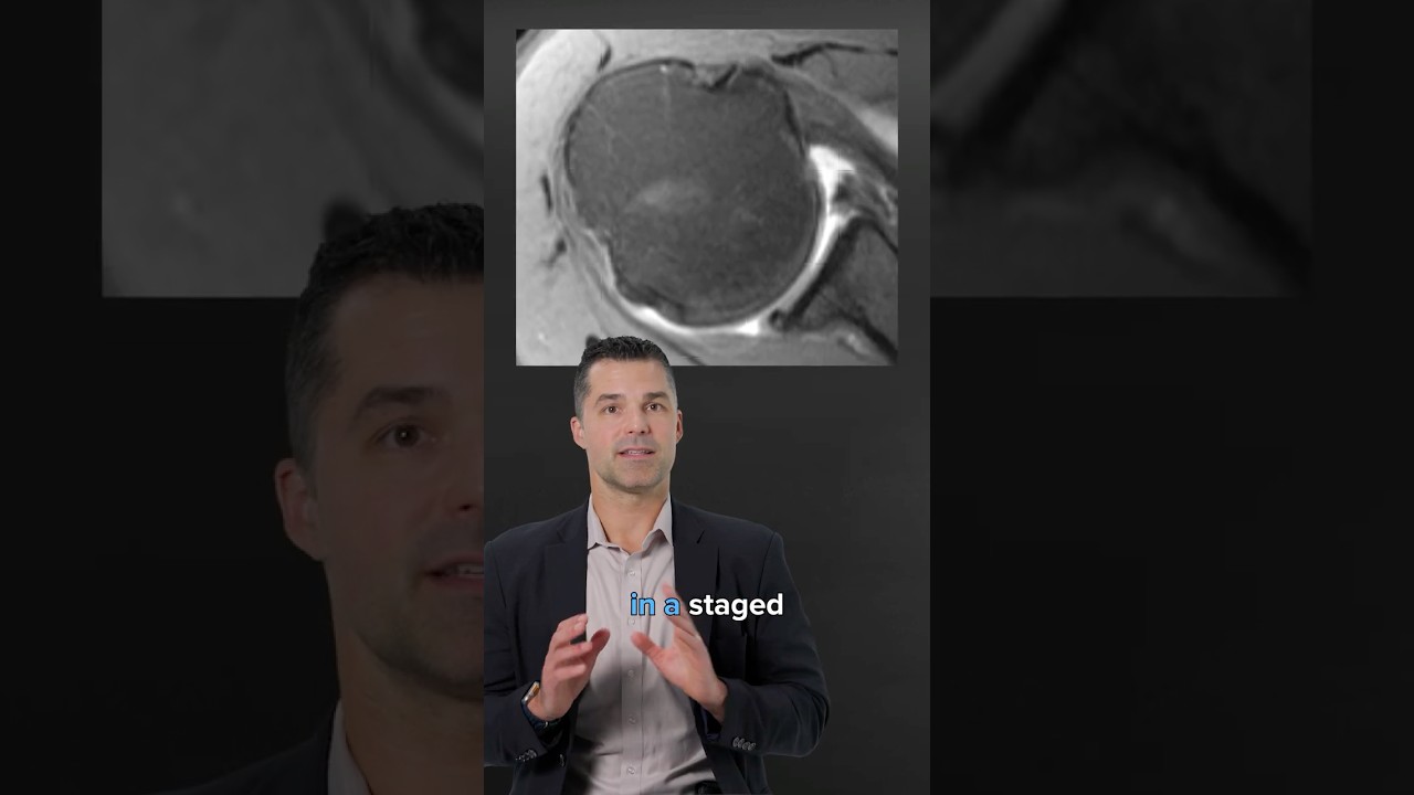 Grant Garcia, MD, Shares Successful Outcomes Following Bilateral Bankart Repair and Remplissage