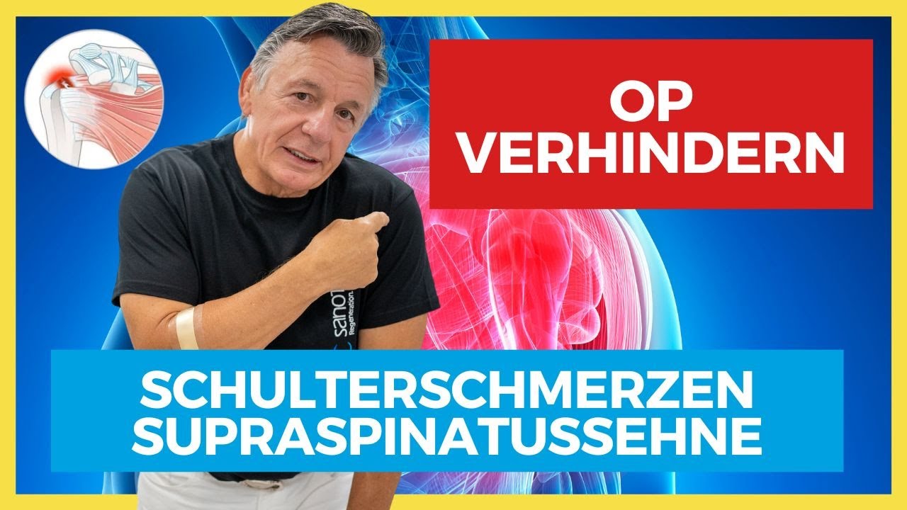 Supraspinatussehne ⚡️ Hilfe bei Schulterschmerzen - OP VERHINDERN!