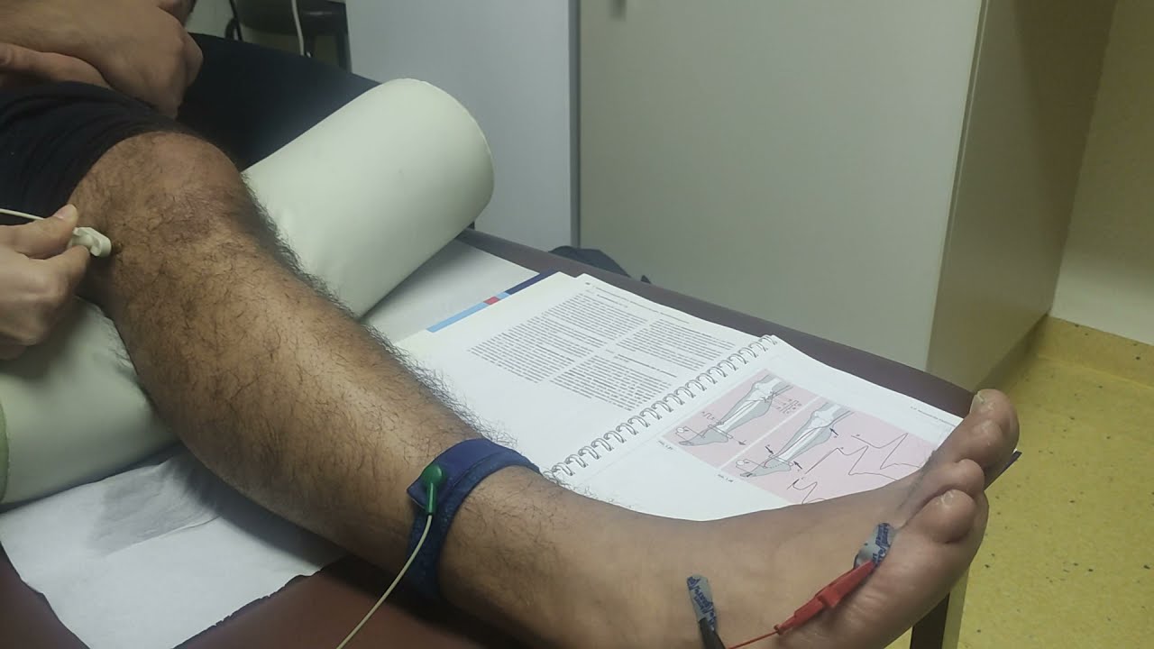 Motorische ENG: N. peroneus (Elektroneurographie)