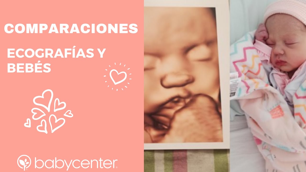 Comparaciones de ecografías y bebés