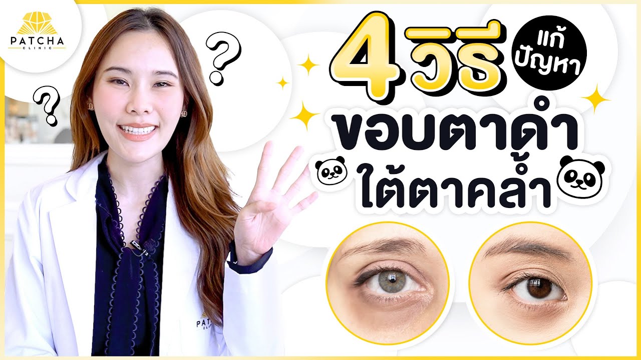 4 วิธีแก้ปัญหา ขอบตาดำ ใต้ตาคล้ำ ให้กลับมาดูสดใส