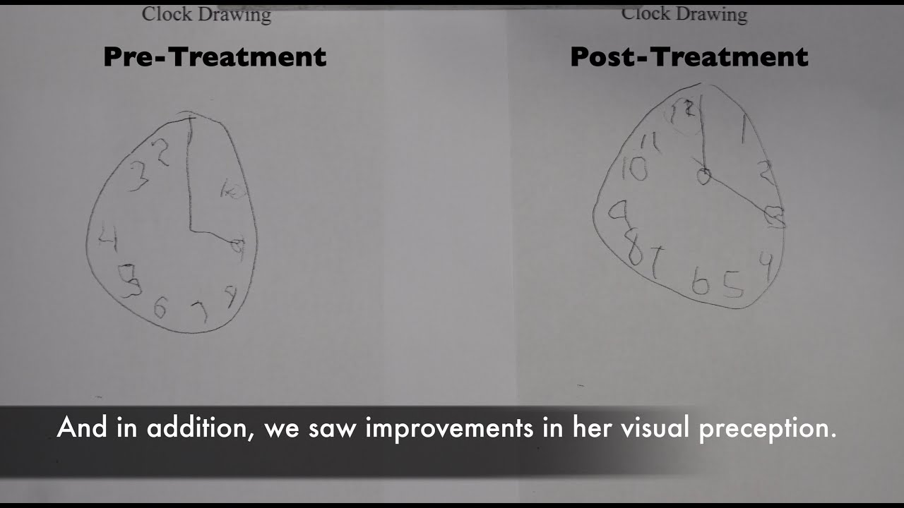 Stroke Breakthrough Treatment by Edward Tobinick, M.D. in December 2019.