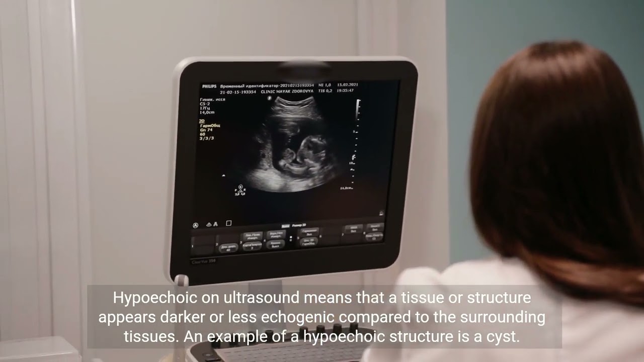 what is meant by echogenicity in ultrasound.hypoechoic and Hyper echoic terms on ultrasound