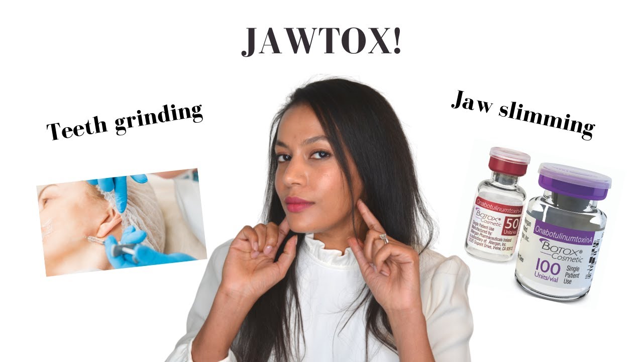 Masseter Botox for teeth grinding & jaw slimming?