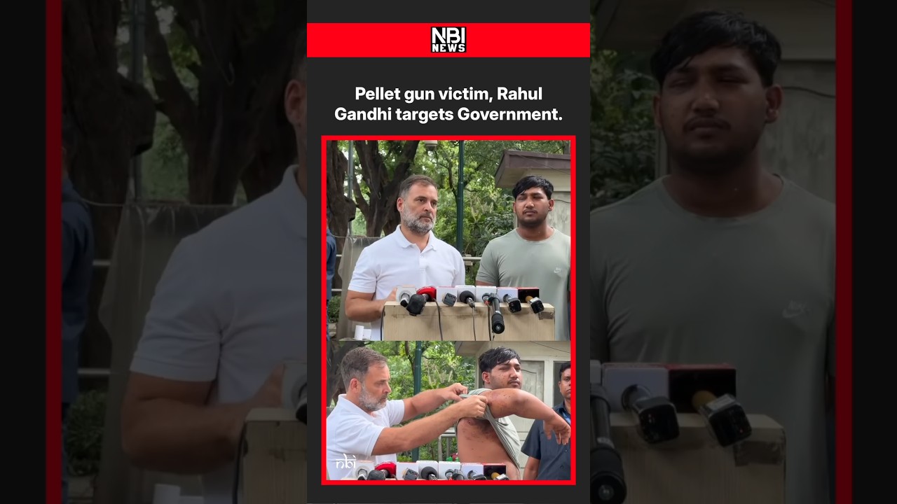 Pellet gun victim, Rahul Gandhi targets Government.